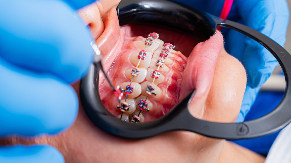 Close-up of dental braces being examined by dentist using tools with gloves. West Covina Dentist Orthodontics