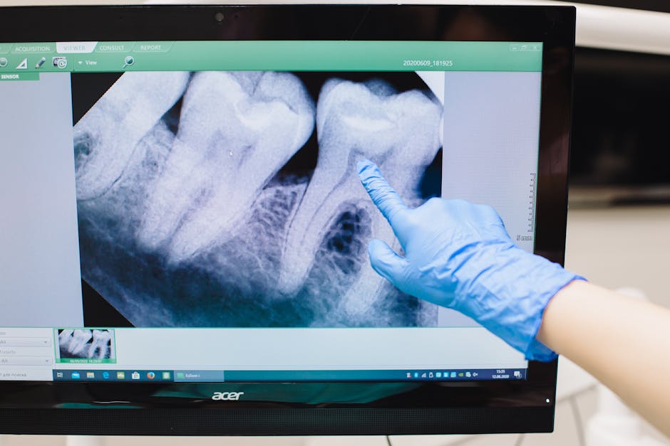 Close-up of a dental X-ray displayed on a monitor with a gloved hand pointing.